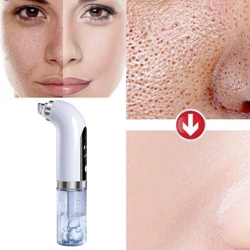 Hidro-Skin Facial Pro ™ - Dê o Melhor para a sua pele! - Lojas Maiora